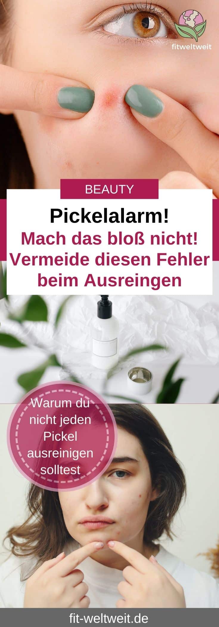 Pickelalarm! Mach das bloß nicht! Vermeide diesen Fehler beim Ausreinigen deiner Pickel. Warum du nicht jeden Pickel ausreinigen solltest!