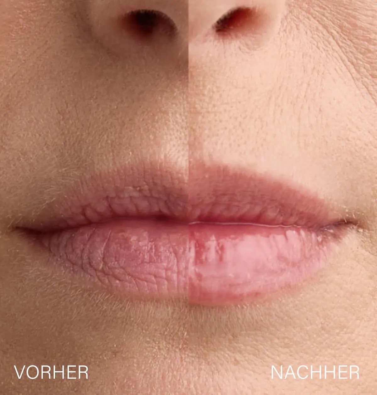 Produktfoto